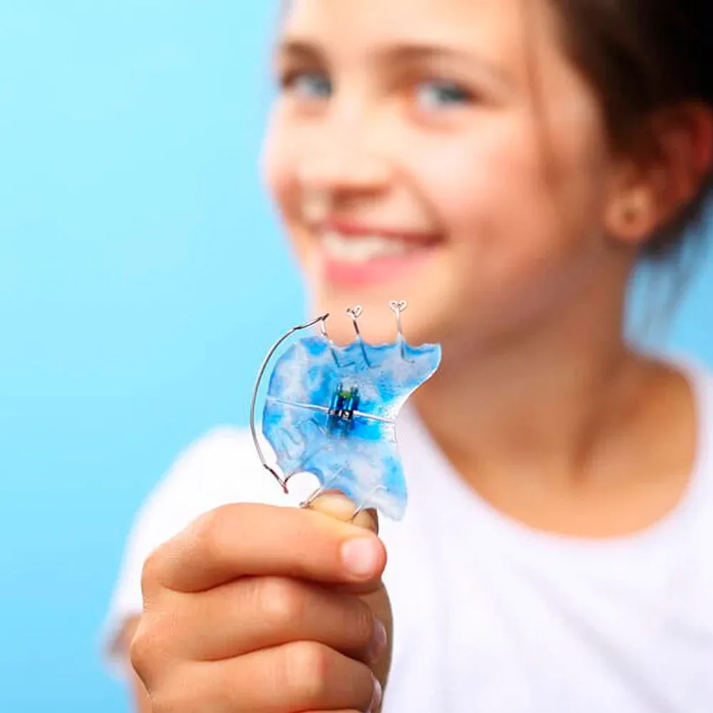 Removable acrylic and wire orthodontic appliance