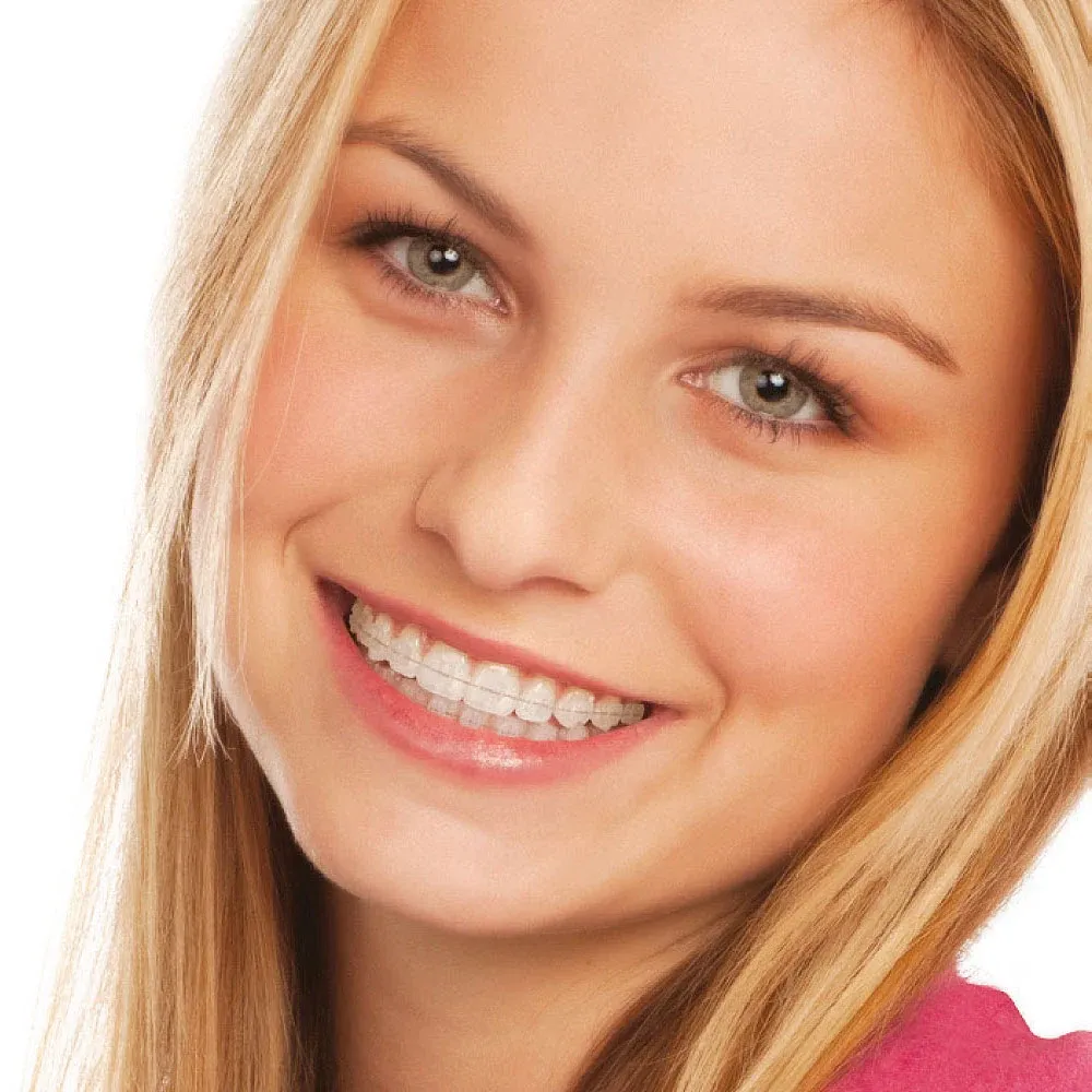 Sorriso com aparelho estético de safira