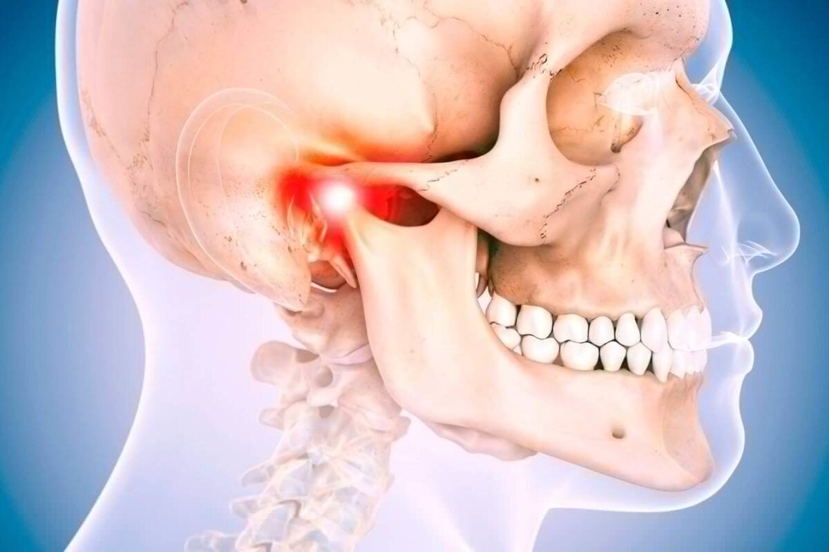 Mandíbula estalando ao abrir e fechar a boca pode ser sinal de disfunção na  ATM (Disfunção Temporomandibular) - Hospital da Face